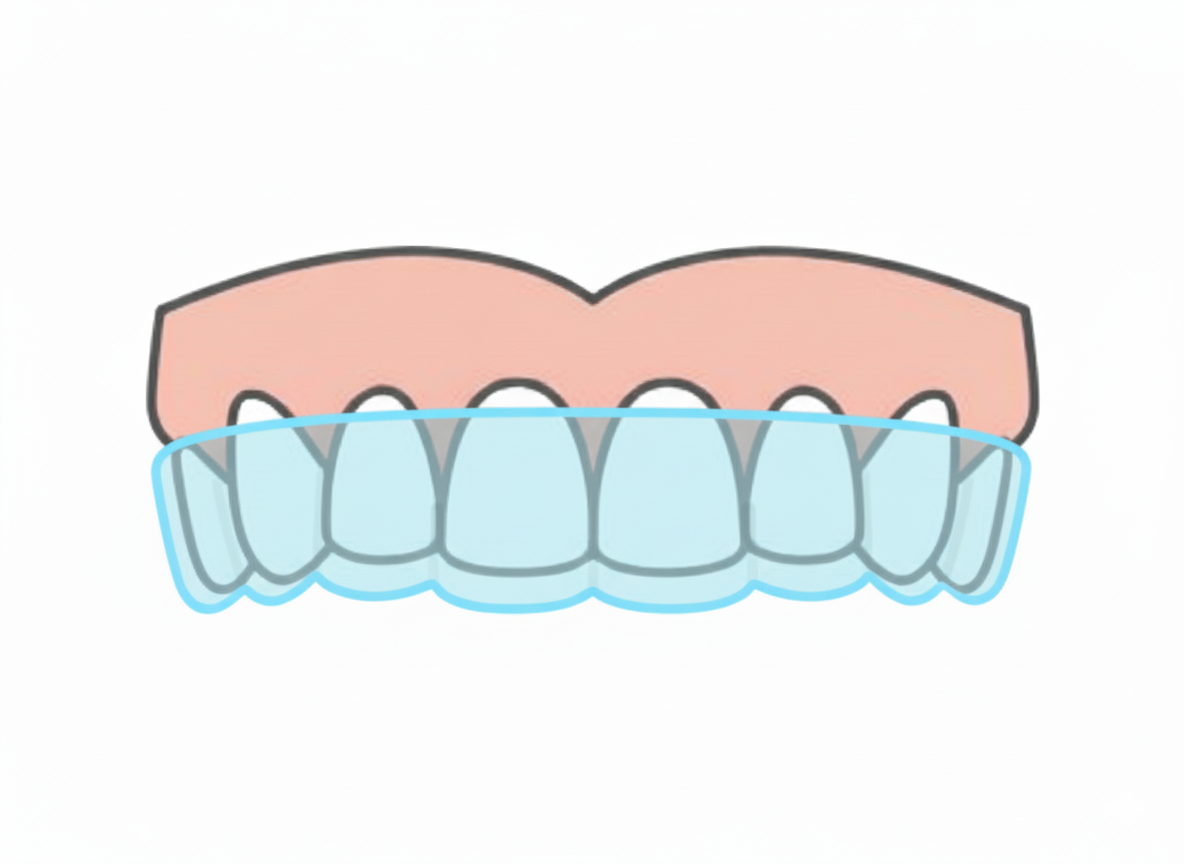 Invisalign®